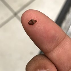 Jin Young Coin Laundry - Here's the bed bug