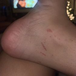 Lavie Nails - My ankle after a pedicure