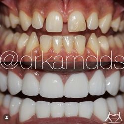 Agoura Advanced Dentistry - Everything from shade to shape is customized by design. Schedule a consultation with Dr. Kam about your smile makeover.