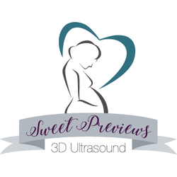 Sweet Previews 3D Ultrasound