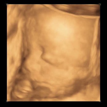 Prenatal Angels - Cute 4D ultrasound side profile. Book on our website for your next 3D/4D ultrasound - Ultrasound Imaging Centers Near Me - Lakewood, California Prenatal Angels - Cute 4D ultrasound side profile. Book on our website for your next 3D/4D ultrasound - Ultrasound Imaging Centers Near Me - Lakewood, California