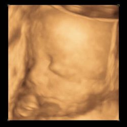 Prenatal Angels - Cute 4D ultrasound side profile. Book on our website for your next 3D/4D ultrasound