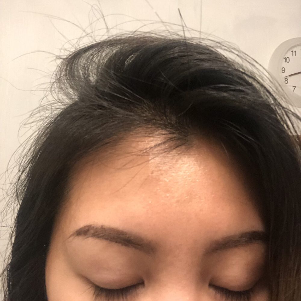 CC Cosmetics - 5 days after session, dark brows with patches peeling off - Nail Salons Near Me - San Jose, California