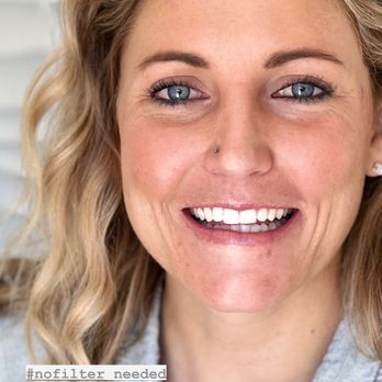 Glintr Mobile Teeth Whitening - No filter needed after 60 minutes with @getglintr! - Teeth Whitening Near Me Glintr Mobile Teeth Whitening - No filter needed after 60 minutes with @getglintr! - Teeth Whitening Near Me