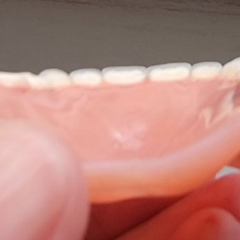 Affordable Dentures & Implants - Upside down dentures - Prosthodontists Near Me - Kearney, Missouri