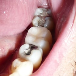 Ron Barry, DMD - It's the pretty one between the Fillings.