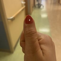 Thumbs looked horrible