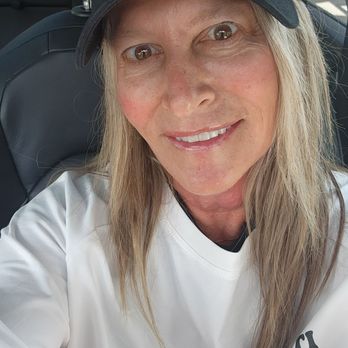 Skin Club Medical Spa - After the treatments still smiling - Tattoo Removal Near Me - Deerfield Beach, Florida Skin Club Medical Spa - After the treatments still smiling - Tattoo Removal Near Me - Deerfield Beach, Florida
