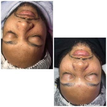 FacingIT - Skin Care Near Me - East Point, Georgia