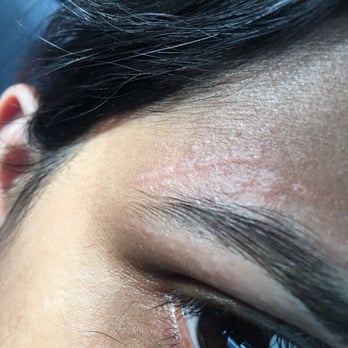 Renu Beauty Salon - This is how I left the place with burning pain - Threading Services Near Me - Yonkers, New York Renu Beauty Salon - This is how I left the place with burning pain - Threading Services Near Me - Yonkers, New York