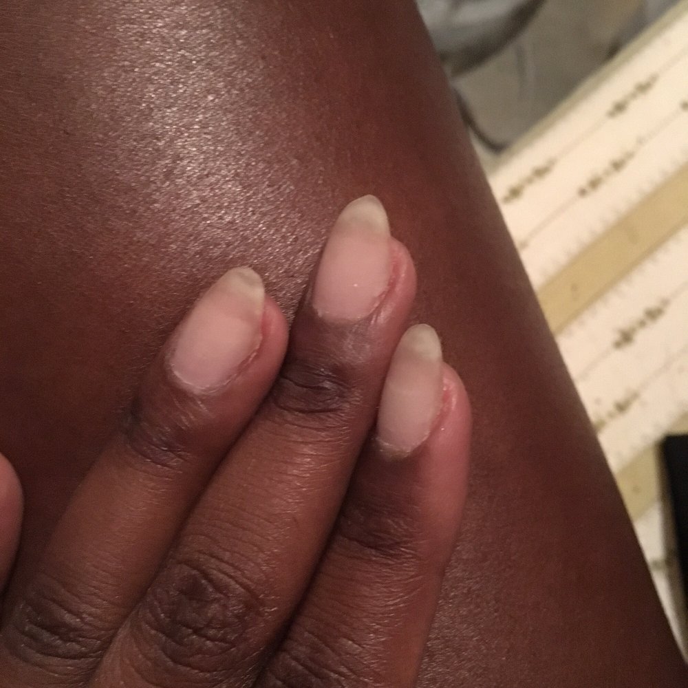 Krazy Nails - My skin was cut and burned , she filed too deep into my skin . - Nail Salons Near Me - Paterson, New Jersey Krazy Nails - My skin was cut and burned , she filed too deep into my skin . - Nail Salons Near Me - Paterson, New Jersey