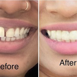 I love this dentist and she is very experienced and hard working women. She does her job very well and makes her patients comfortable I love this dentist and she is very experienced and hard working women. She does her job very well and makes her patients comfortable