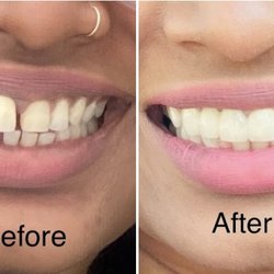 Chartwell Dental Group - I love this dentist and she is very experienced and hard working women. She does her job very well and  makes her patients comfortable
