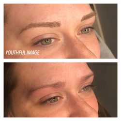 Youthful Image - Microblading before and after