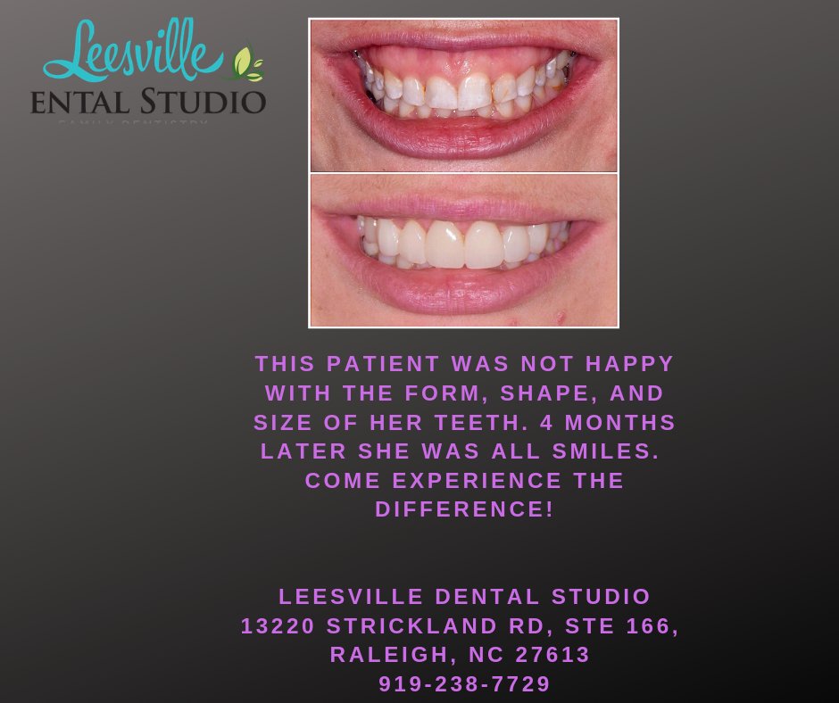 LEESVILLE DENTAL STUDIO Updated September 2024 13 Photos 13220