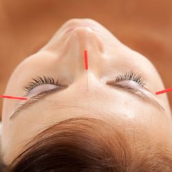 Facial Rejuvenation