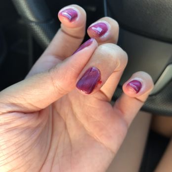Classy Nails Bar - Won't stop bleeding - Nail Salons Near Me - Norco, California Classy Nails Bar - Won't stop bleeding - Nail Salons Near Me - Norco, California