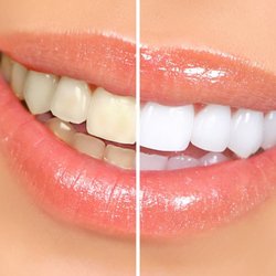 Infinity Dental