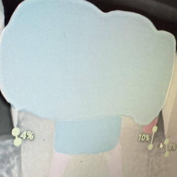 West Cobb Dentist Office - Red area is where underlying tooth structure is still visible from 2nd opinion X-Rays - General Dentistry Near Me - Marietta, Georgia West Cobb Dentist Office - Red area is where underlying tooth structure is still visible from 2nd opinion X-Rays - General Dentistry Near Me - Marietta, Georgia