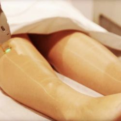 Luxurious Beauty Studios - Get ready for shorts and summer dresses with our amazing laser treatments!!!!