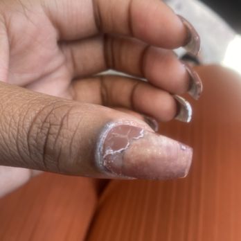 Hot Nails - Monday day 3 after nails done at Hot nails 885 S Babcock St Melbourne, FL  32901 United States - Nail Salons Near Me - Melbourne, Florida