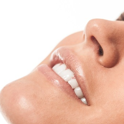 Jasmine Laser Hair Removal