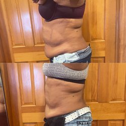 Kakes Contours - Body sculpting bundle package