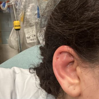 Eleven + Luxe - ER visit that is costing me more money - Piercing Near Me - Burlingame, California Eleven + Luxe - ER visit that is costing me more money - Piercing Near Me - Burlingame, California