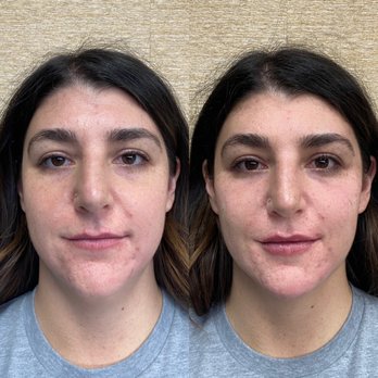 Stark Aesthetics - Medical Spas Near Me - Beverly Hills, California
