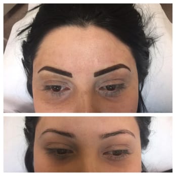 Scalp La - Scalp Micropigmentation - Hair Loss Centers Near Me - Sherman Oaks, California