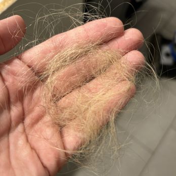 Unicorn Hair Extensions - Hair loss from poor bead installation on an autoimmune patient causing irreversible damage - Hair Extensions Near Me - Dallas, Texas