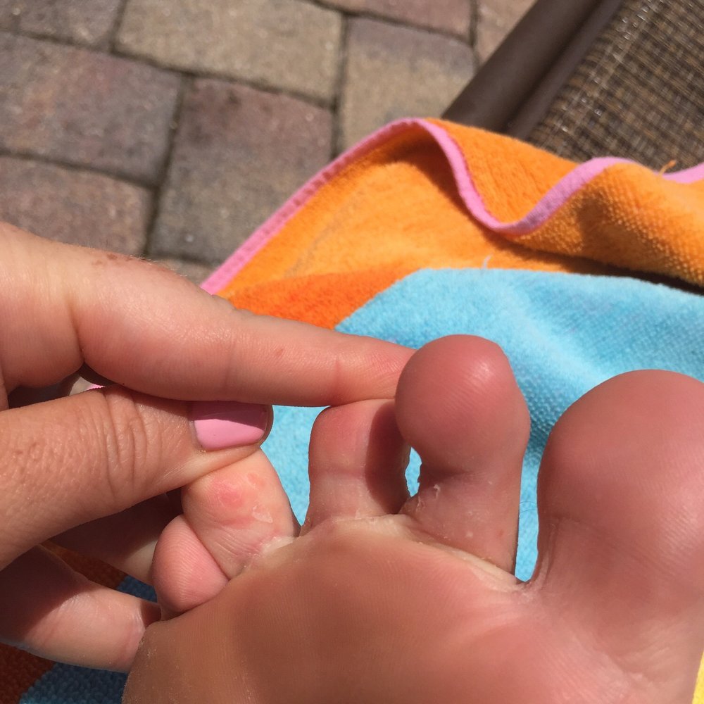 Oscar Nails & Spa - Toes itchy and peeling hours after too.. - Nail Salons Near Me - Vero Beach, Florida Oscar Nails & Spa - Toes itchy and peeling hours after too.. - Nail Salons Near Me - Vero Beach, Florida