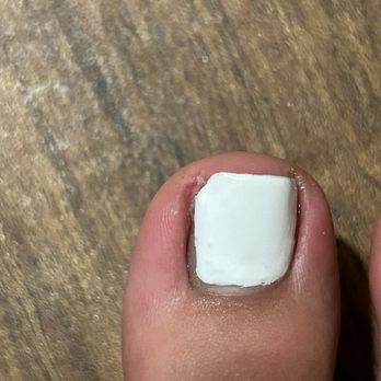 Top City Nails - Ingrown - Nail Salons Near Me - Riverside, California