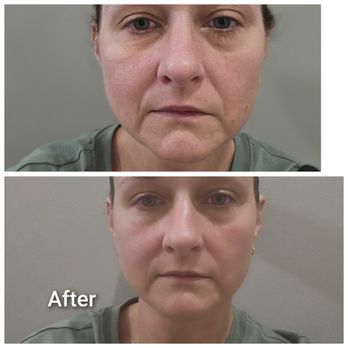 A New Slimmer You - Before and After - Cosmetics & Beauty Supply Near Me - Hendersonville, Tennessee A New Slimmer You - Before and After - Cosmetics & Beauty Supply Near Me - Hendersonville, Tennessee