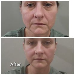 A New Slimmer You - Before and After