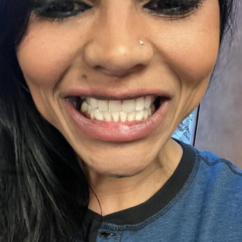 Smile Cafe Dental Spa - The pearly whites - Cosmetic Dentists Near Me - New York, New York Smile Cafe Dental Spa - The pearly whites - Cosmetic Dentists Near Me - New York, New York