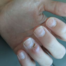 This is my friends hand after coming to TN nails. She said none of the employees washed the tools between customers!