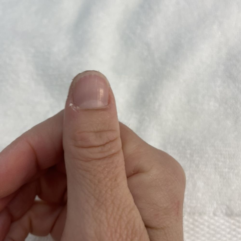 Nail Art SF - saddddd dry thumb pt 2 - Nail Salons Near Me - San Francisco, California Nail Art SF - saddddd dry thumb pt 2 - Nail Salons Near Me - San Francisco, California