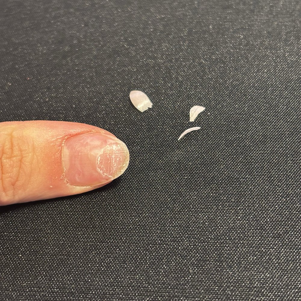 Nails Spa & Beyond - Acrylic that came off of nail a day after doing "acrylic removal" at their salon for $25 - Nail Salons Near Me - New York, New York