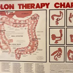 Relax Colon Hydro-Therapy & More - Colon chart