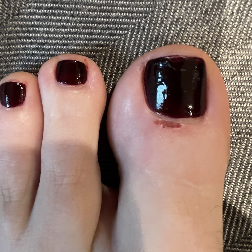 Pinklicious Nails & Spa - Bleeding cuticle - Nail Salons Near Me - Wilmette, Illinois Pinklicious Nails & Spa - Bleeding cuticle - Nail Salons Near Me - Wilmette, Illinois