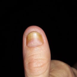 Ewwwww and ouch! Ewwwww and ouch!