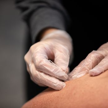 KinetikChain Denver Physical Therapy - Physical Therapy Near Me - Denver, Colorado KinetikChain Denver Physical Therapy - Physical Therapy Near Me - Denver, Colorado