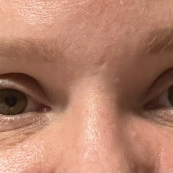 B Sweet - Before - Permanent Makeup Near Me - Pflugerville, Texas