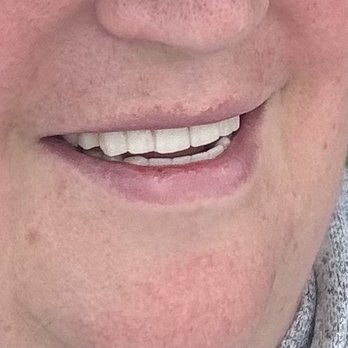 Levesque Dentistry - General Dentistry Near Me - Nashua, New Hampshire