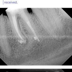 8 to 8 Dental - Lynnwood - This is why I hate dentists