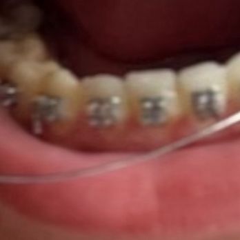Dr Maritza De Jesus - Orthodontists Near Me - Orlando, Florida Dr Maritza De Jesus - Orthodontists Near Me - Orlando, Florida