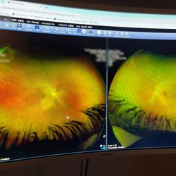 The Eye Shop Optometry - Inside my eyeball...