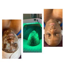 Beauty Dimensions - Try our Clear Beauty Facial . www.beautydimensions.org