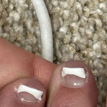 @ Nails - bad french tip pedicure - Nail Salons Near Me - San Luis Obispo, California @ Nails - bad french tip pedicure - Nail Salons Near Me - San Luis Obispo, California